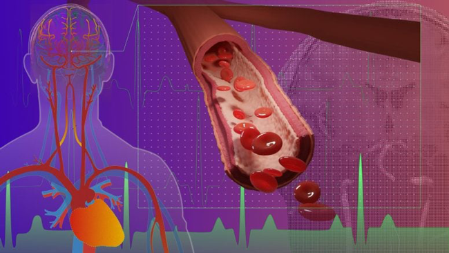 گو و همکاران یک تکنیک نوین MRI در میدان ۷ تسلا ارائه کرده‌اند که برای نخستین بار امکان نگاشت لایه‌ای تپش حجم میکروواسکولار مغز در نواحی قشر و ماده سفید را فراهم می‌کند.