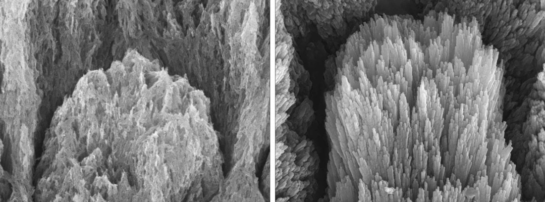 تصاویر میکروسکوپ الکترونی از دندانی با مینای دندان از بین رفته، که کریستال‌های آپاتیت فرسوده را نشان می‌دهد (سمت چپ)، و یک دندان مشابه پس از دو هفته درمان که کریستال‌های مینای دندان بازسازی‌شده به‌صورت اپیتاکسیال را نشان می‌دهد (سمت راست).
