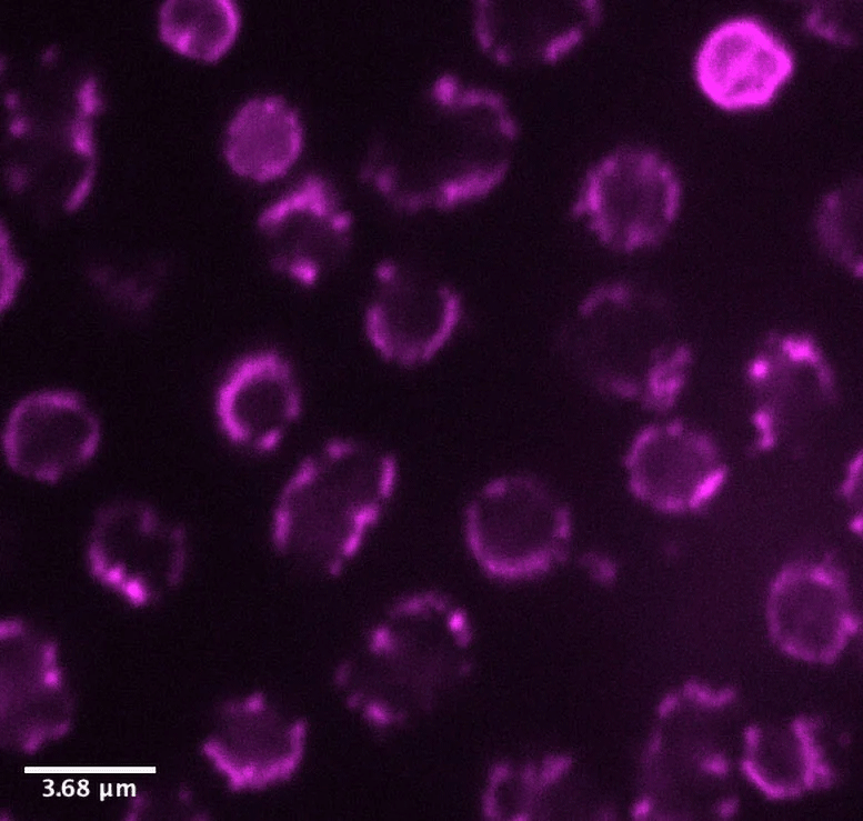 آرکیهای تولیدکنندهٔ متان از گونهٔ Methanosarcina acetivorans. این میکروبها با یک رنگ فلورسانت مشخص رنگآمیزی شدهاند که بهطور ویژه به غشاهای آرکیها میچسبد.