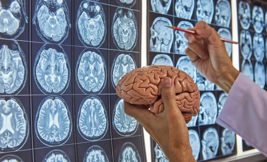 مولکولهای روزهداری سلامت مغز را بهبود میدهند