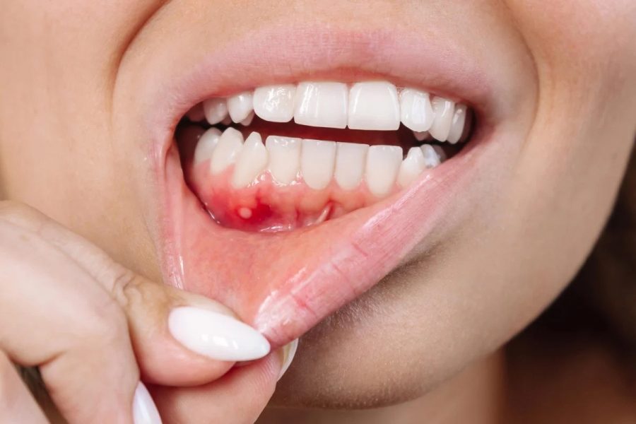 مشکل رایج دندانی سلامت مغز را تهدید می‌کند